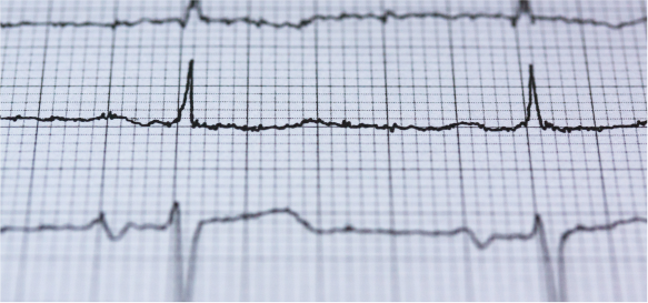 汽車金融高速增長 融資租賃風(fēng)口開啟_騰凱融資租賃